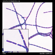 bacillus anthracis